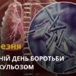Так! Ми можемо подолати туберкульоз